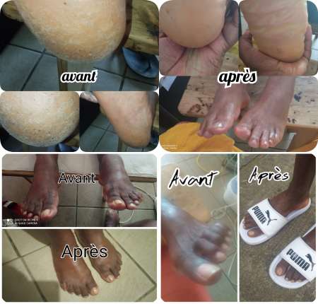 Photo ads/2146000/2146450/a2146450.jpg : Soins des pieds traditionnel